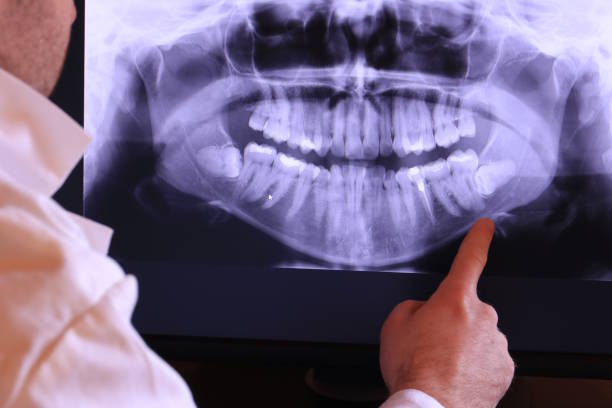 Best Urgent Care for Lost Fillings or Crowns in Swoyersville, PA