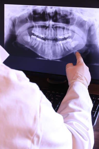 Best Emergency Dental Care for Broken or Chipped Teeth in Swoyersville, PA